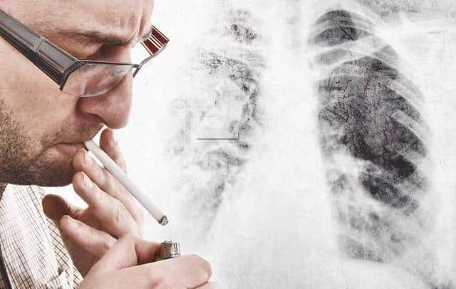 Cai thuốc lá hiệu quả từ 3 -5 ngày | Cai thuốc lá Nosmoking