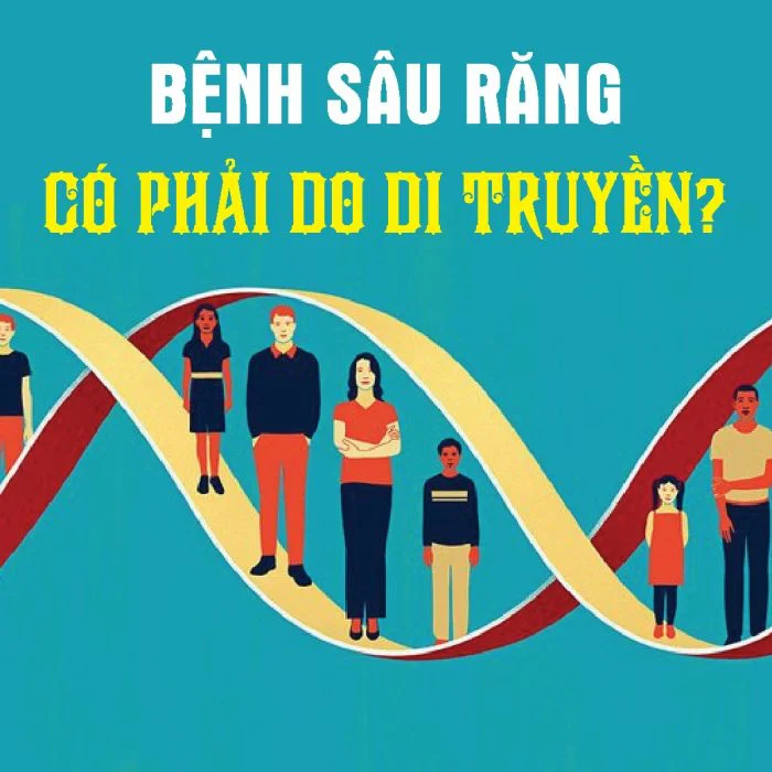 BỆNH SÂU RĂNG CÓ PHẢI DO DI TRUYỀN?