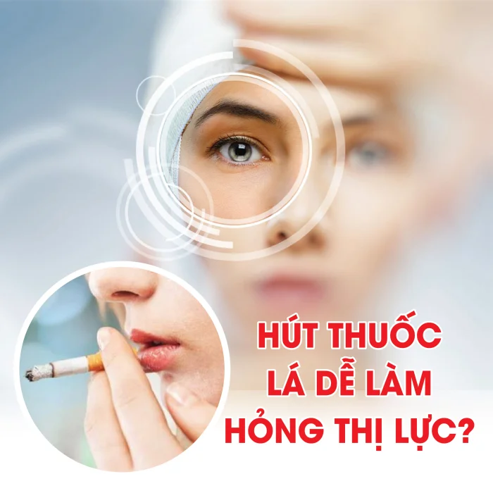 HÚT THUỐC LÁ DỄ LÀM HỎNG THỊ LỰC?