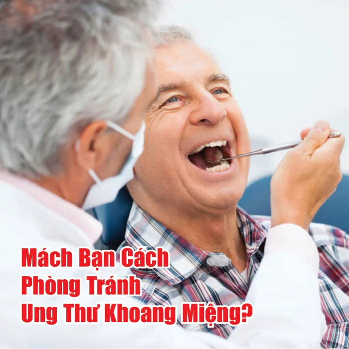 MÁCH BẠN CÁCH PHÒNG TRÁNH UNG THƯ KHOANG MIỆNG!