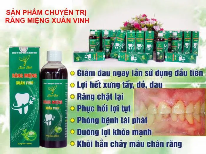 TẠI SAO NÊN LỰA CHỌN ĐẶC TRỊ RĂNG MIỆNG XUÂN VINH?